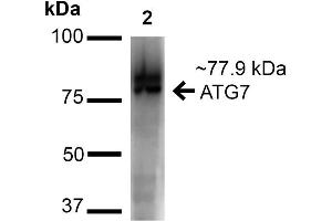 Western blot analysis of Human Cervical Cancer cell lysates (HeLa) showing detection of ~77. (ATG7 anticorps  (N-Term) (Atto 594))