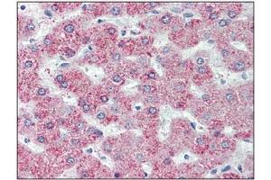 Immunohistochemistry: GPR146 antibody staining of Formalin-Fixed, Paraffin-Embedded Human Liver. (GPR146 anticorps  (Internal Region))