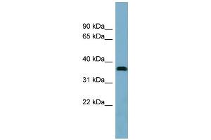 WB Suggested Anti-NEURL2 Antibody Titration: 0.