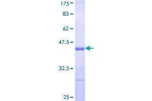 Image no. 1 for Tenascin R (Restrictin, Janusin) (TNR) (AA 411-519) protein (GST tag) (ABIN1323304)