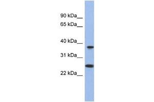 WB Suggested Anti-MTRF1L Antibody Titration: 0. (MTRF1L anticorps  (N-Term))