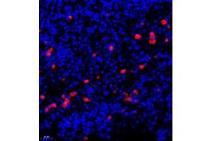 Immunofluorescence of paraffin embedded human lymph node using CSF1 (ABIN7073553) at dilution of 1:900 (400x lens) (M-CSF/CSF1 anticorps)