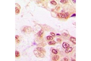 Immunohistochemistry (IHC) image for anti-Protein tyrosine Phosphatase, Non-Receptor Type 2 (PTPN2) antibody (ABIN7308244)