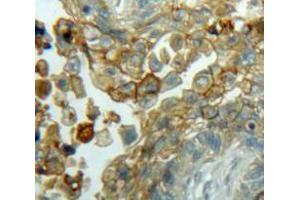 Used in DAB staining on fromalin fixed paraffin-embedded Lung tissue (Cyclin D3 anticorps  (AA 1-292))