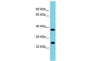Host: Rabbit Target Name: MRPS26 Sample Type: 721_B Whole Cell lysates Antibody Dilution: 1. (MRPS26 anticorps  (C-Term))