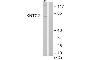 Western blot analysis of extracts from Jurkat cells, using KNTC2 antibody. (NDC80 anticorps  (Internal Region))