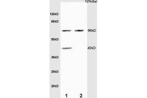 SDS-PAGE (SDS) image for anti-Elastin (ELN) (AA 681-786) antibody (ABIN734003)