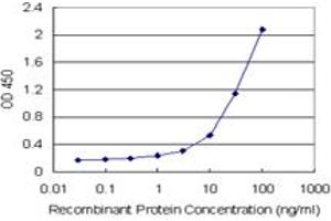 E2F6 (Human) Matched Antibody Pair