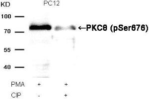 Western blot analysis of extracts from PC12 cells, treated with PMA or calf intestinal phosphatase (CIP), using PKCθ (Phospho-Ser676) Antibody. (PKC theta anticorps  (pSer676))