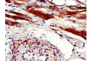 Immunohistochemistry of paraffin-embedded human heart tissue using ABIN7146837 at dilution of 1:100