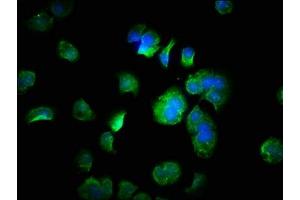 Immunofluorescence staining of MCF-7 cells with ABIN7152879 at 1:333, counter-stained with DAPI. (FANK1 anticorps  (AA 1-345))