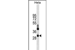 Western blot analysis of anti-CLIC4 Monoclonal Antibody ABIN387769 in Hela cell line lysates.