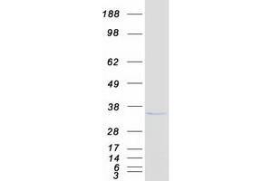 Validation with Western Blot