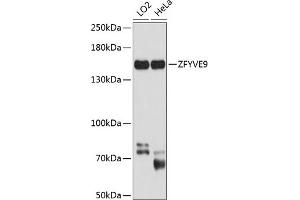 Western blot analysis of extracts of various cell lines, using ZFYVE9 antibody (ABIN6133286, ABIN6150442, ABIN6150443 and ABIN6224871) at 1:1000 dilution. (ZFYVE9 anticorps  (AA 1-260))