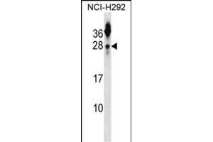 TSN2 Antibody (N-term) (ABIN1539218 and ABIN2848532) western blot analysis in NCI- cell line lysates (35 μg/lane). (Tetraspanin 2 anticorps  (N-Term))
