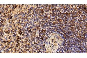 Detection of CD45 in Human Spleen Tissue using Polyclonal Antibody to Protein Tyrosine Phosphatase Receptor Type C (CD45)