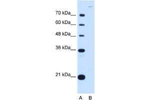 WB Suggested Anti-CDH7 Antibody Titration:  0. (Cadherin 7 anticorps  (N-Term))