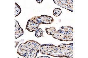 IHC analysis of TOP3B using anti-TOP3B antibody (ABIN7599907). (TOP3B anticorps  (AA 128-824))