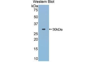 Western blot analysis of the recombinant protein. (TOLLIP anticorps  (AA 28-261))
