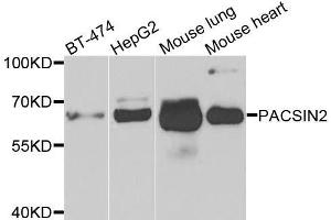 Western blot analysis of extracts of various cell lines, using PACSIN2 antibody. (PACSIN2 anticorps  (AA 240-410))