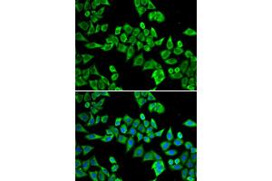 Immunofluorescence analysis of HeLa cells using DDX20 antibody. (DDX20 anticorps)