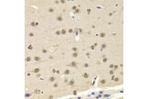 Immunohistochemistry of paraffin-embedded Mouse brain using ETV7 antibody at dilution of 1:100 (x400 lens). (ETV7 anticorps)