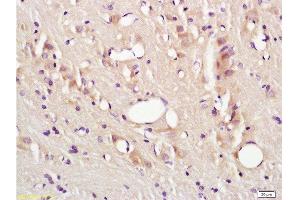 Formalin-fixed and paraffin embedded rat brain tissue labeled with Anti-CD54/ICAM-1 Polyclonal Antibody , Unconjugated at 1:200, followed by conjugation to the secondary antibody and DAB staining