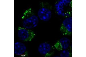 Immunofluorescence staining of Neuro2a mouse neuroblastoma cell line using anti-betaIII-tubulin (TU-20 FITC, green, 1 μg/ml).