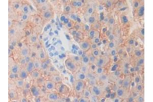 DAB staining on IHC-P; Samples: Human Liver Tissue