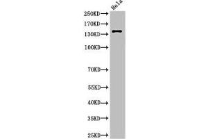 Western Blot analysis of HeLa cells using Cleaved-Spectrin α II (D1185) Polyclonal Antibody