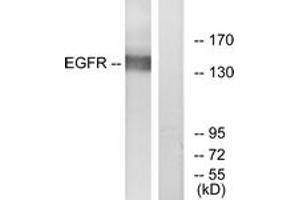 Western blot analysis of extracts from A431 cells, treated with EGF 40myM 10', using EGFR (Ab-869) Antibody. (EGFR anticorps  (AA 836-885))
