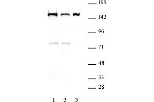DHX9 antibody (mAb) (Clone 8E3) tested by Western blot. (DHX9 anticorps  (N-Term))