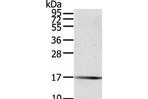 Western Blot analysis of Human fetal muscle tissue using PTPMT1 Polyclonal Antibody at dilution of 1:200 (PTPMT1 anticorps)