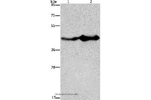 Western blot analysis of Mouse liver and brain tissue, using GLUL Polyclonal Antibody at dilution of 1:600