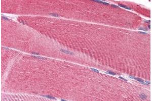 Human Skeletal Muscle: Formalin-Fixed, Paraffin-Embedded (FFPE) (SRPK1 anticorps  (AA 371-470))