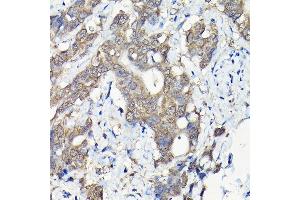 Immunohistochemistry of paraffin-embedded mouse testis using PIWIL4 Rabbit pAb (ABIN6132982, ABIN6145704, ABIN6145705 and ABIN6217111) at dilution of 1:100 (40x lens). (PIWIL4 anticorps  (AA 260-460))