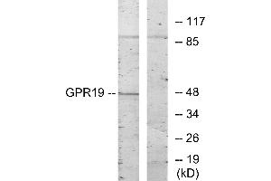 Western blot analysis of extracts from HeLa cells, using GPR19 antibody. (GPR19 anticorps)