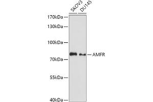 Western blot analysis of extracts of various cell lines, using AMFR antibody (ABIN1678650, ABIN3018012, ABIN3018013 and ABIN6220335) at 1:1000 dilution.