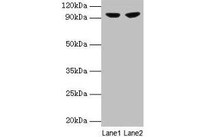 Western blot All lanes: PYGL antibody at 2 μg/mL Lane 1: 293T whole cell lysate Lane 2: HepG2 whole cell lysate Secondary Goat polyclonal to rabbit IgG at 1/10000 dilution Predicted band size: 98, 94 kDa Observed band size: 98 kDa (PYGL anticorps  (AA 2-846))