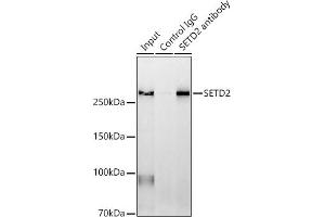 Immunoprecipitation analysis of 600 μg extracts of Mouse spleen using 3 μg SETD2 antibody (ABIN3017564, ABIN3017565, ABIN1682666 and ABIN6220156).