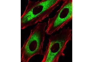 Fluorescent image of Hela cells stained with EEF1B2 Antibody . (EEF1B2 anticorps  (AA 54-86))