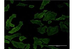 Immunofluorescence of monoclonal antibody to RASA1 on HeLa cell.
