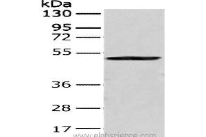 Western Blot analysis of 293T cell using CRTAM Polyclonal Antibody at dilution of 1:250 (CRTAM anticorps)
