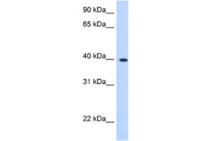 Western Blotting (WB) image for anti-Lipoic Acid Synthetase (LIAS) antibody (ABIN2463206) (LIAS anticorps)