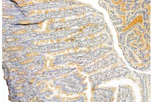ABIN6262482 and ABIN6272876 at 1/100 staining Rat colon tissue by IHC-P.