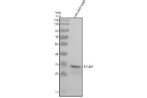 Western blot analysis of TOLLIP using anti-TOLLIP antibody (AZQ7ZV43).