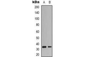 Western blot analysis of CDK4 expression in HepG2 (A), K562 (B) whole cell lysates. (CDK4 anticorps  (N-Term))