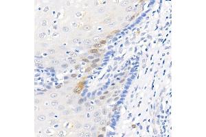Immunohistochemistry of paraffin-embedded rat brain using [KO Validated] LC3B Rabbit mAb (ABIN7268519) at dilution of 1:100 (40x lens).