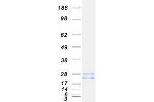 Validation with Western Blot