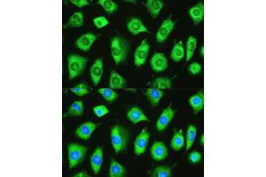 Immunofluorescence analysis of L929 cells using YTHDF1 Rabbit pAb  at dilution of 1:100. (YTHDF1 anticorps)